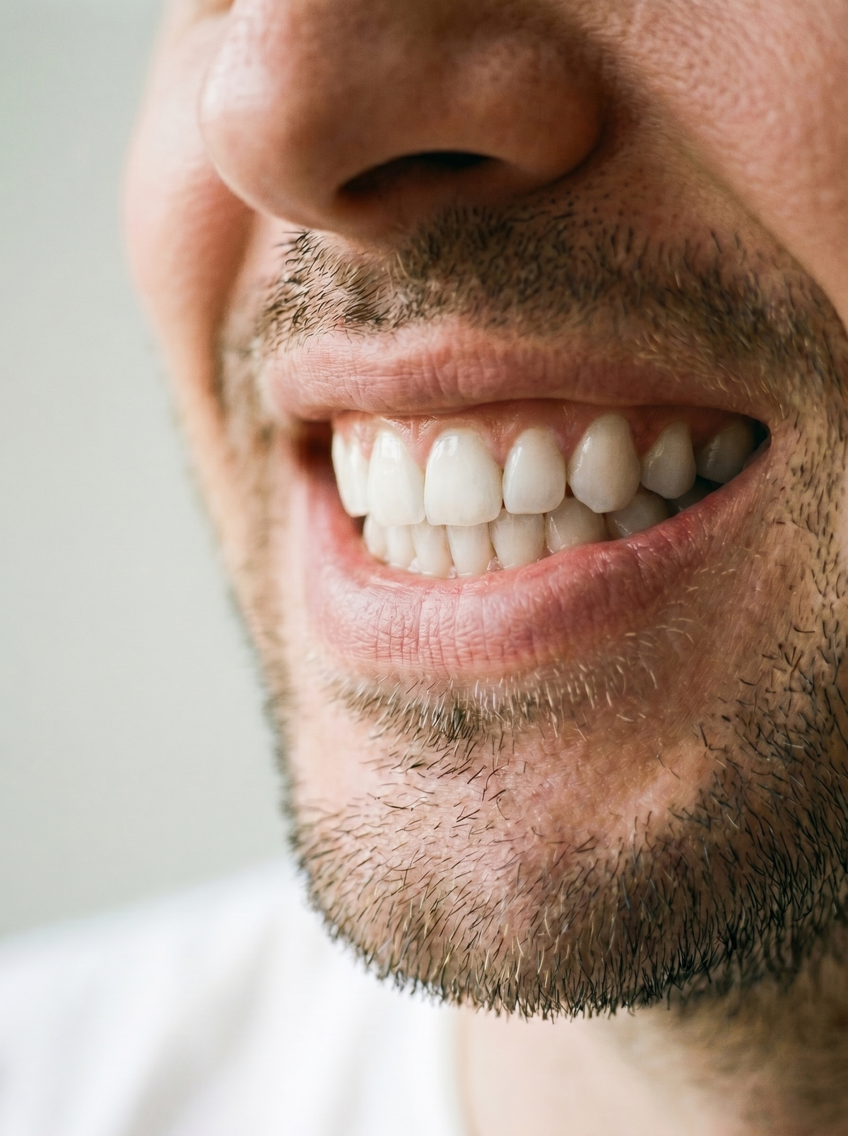 DENTIFRICIO AL CARBONE VEGETALE dopo