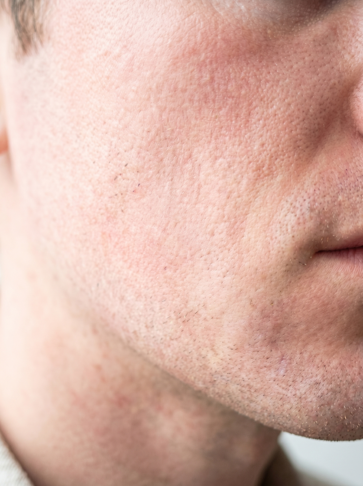 CREMA DA BARBA LENITIVA ALL'ALOE dopo